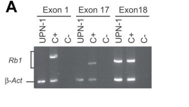 Question: Would a whole exon deletion cause this PCR reaction, if not whatwould?