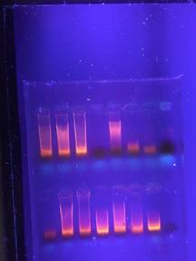 Question: We did a experiment on pepsin vs nucleic acid. We performed agel electrophoresis to get this.I ...