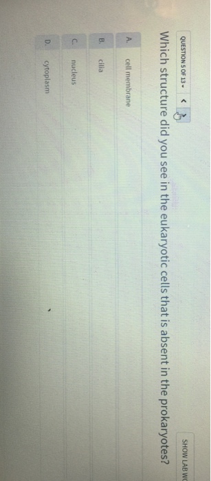 Question: Which structure did you see in the eukaryotic cells that is absent in the prokaryotes?