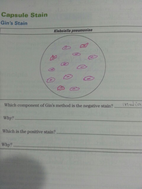 Question: Which component of Gin's method is the negative stain?  Why?  Which is the positive stain?  Why?