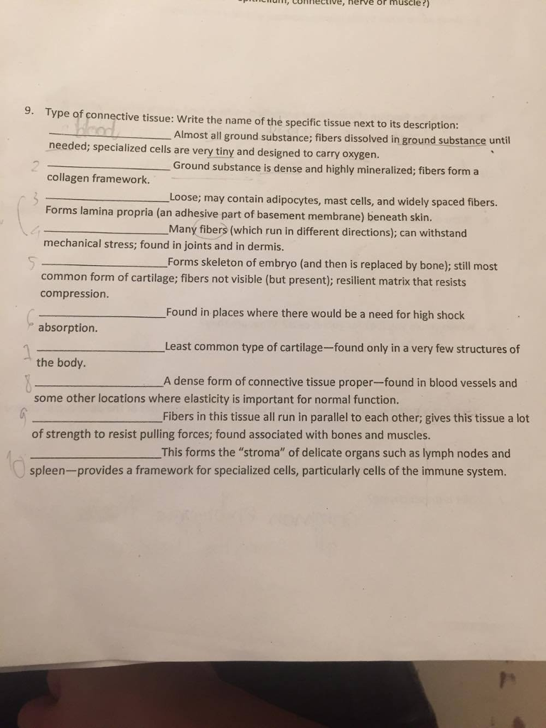 Question: Type of connective tissue: Write the name of the specific tissue next to its description: _______...