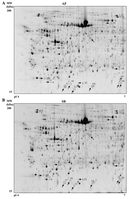 Question: High-resolution 2-D electrophoresis(DE) proteomic analysis of atrial tissue. Representative 2-DE...