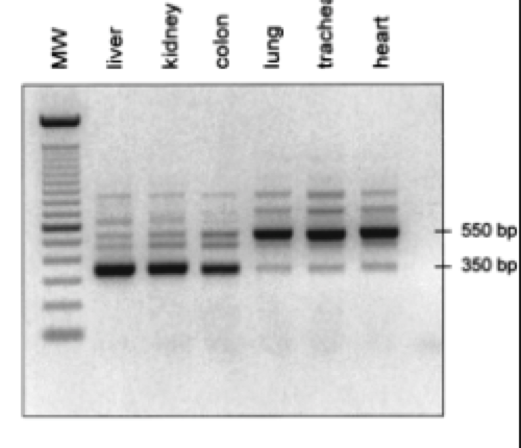 Question: 1. A student extracted gene Xfrom cells from different organs and used northern blot to see the...