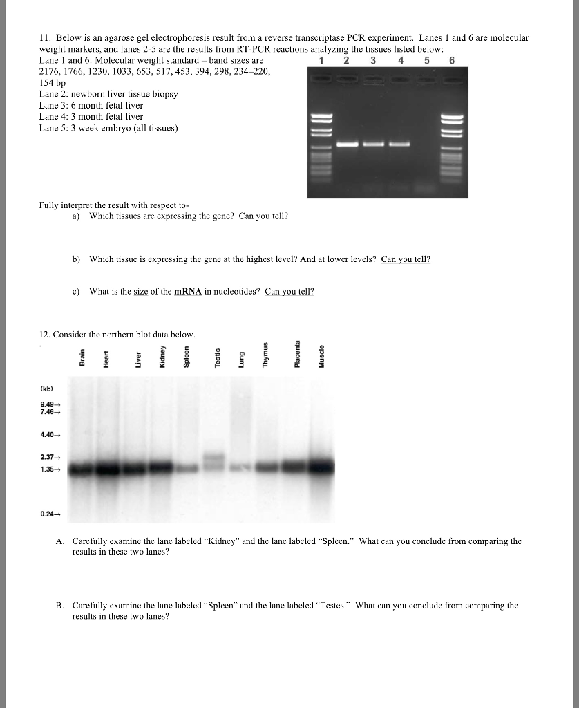 Question: 11. Below is an agarose gel electrophoresis result from a reverse transcriptase PCR experiment. L...