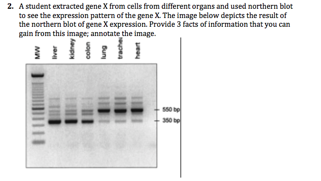 Question: A student extracted gene X from cells from different organs and used northern blot to see the exp...