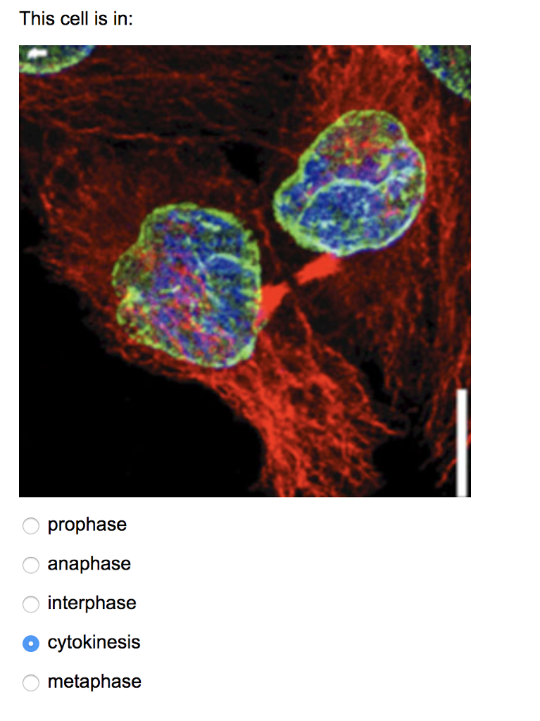 Question: This cell is in: prophase anaphasee interphase cytokinesis metaphase