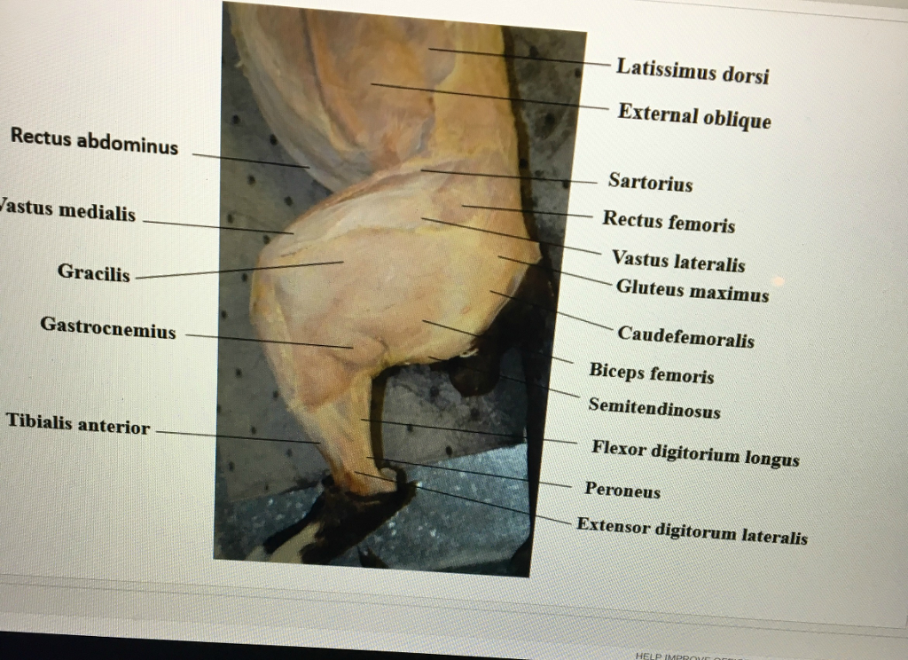 Question: This my image labeled correctly? Where would Soleus and tensorfasciae latae be?