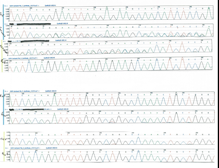 Aaaaaaaa essay 04 picture