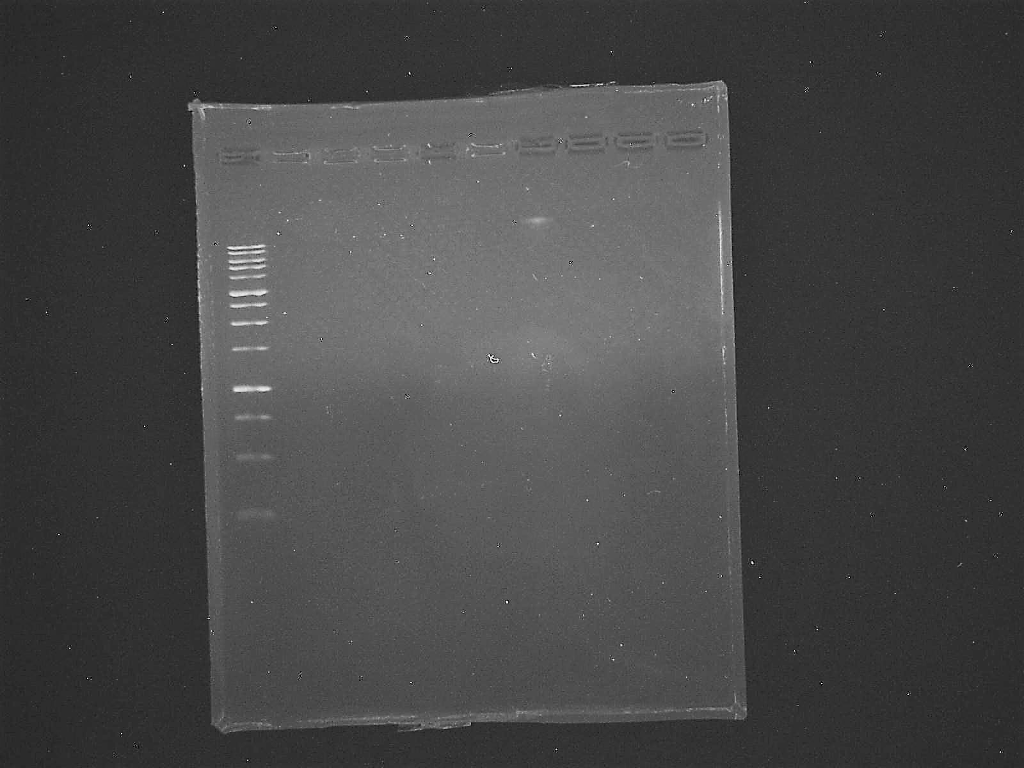 Question: A. Provide ANALYSIS of the of the following DNA band​on&nbsp;&nbsp;agarose gel(picture)b. Was...