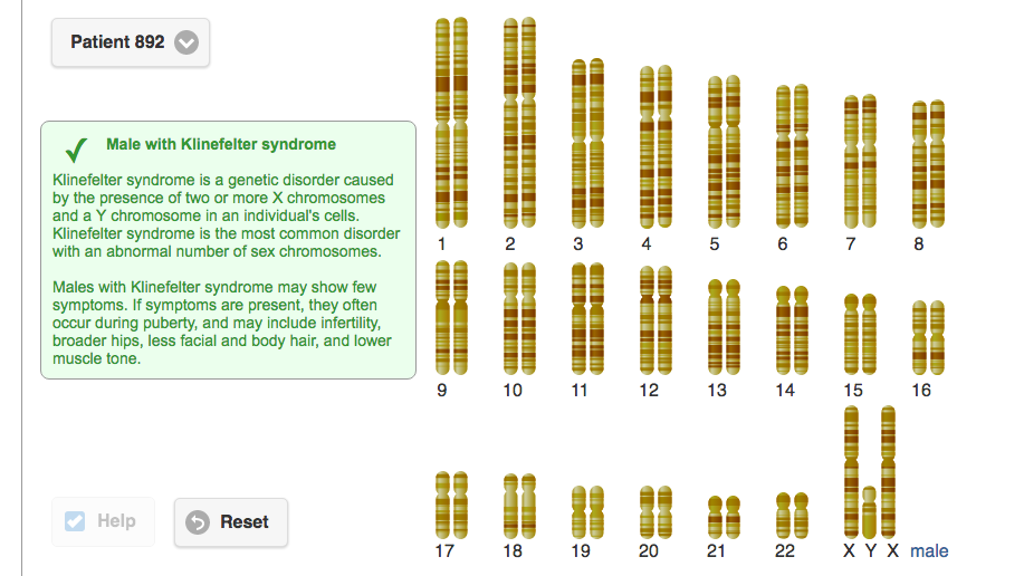 Solved Use The Karyotypes Interactive Abnormal Karyogram Chegg