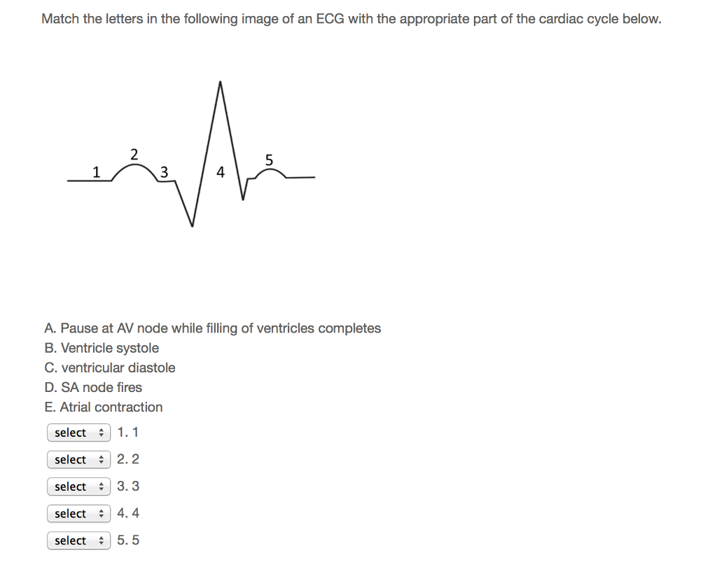 Match The Letters In The Following Image Of An ECG...