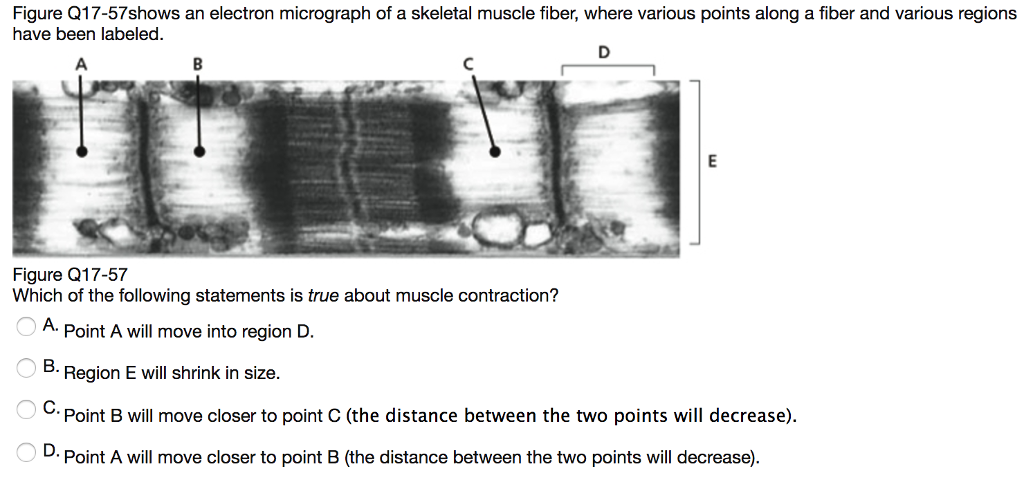 Solved Figure Q Shows An Electron Micrograph Of A Chegg