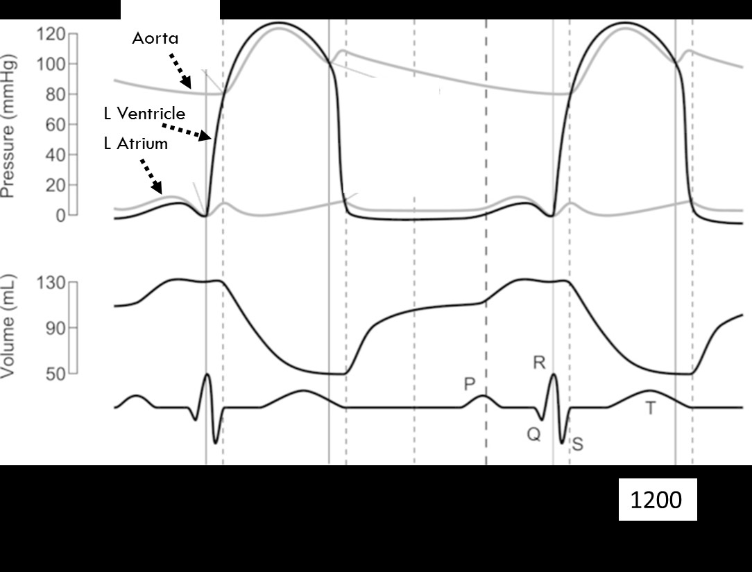 How To Calculate Heart Rate From Wiggers Diagram Haiper