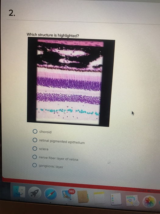 solved-which-structure-is-highlighted-choroid-retinal-pi-chegg