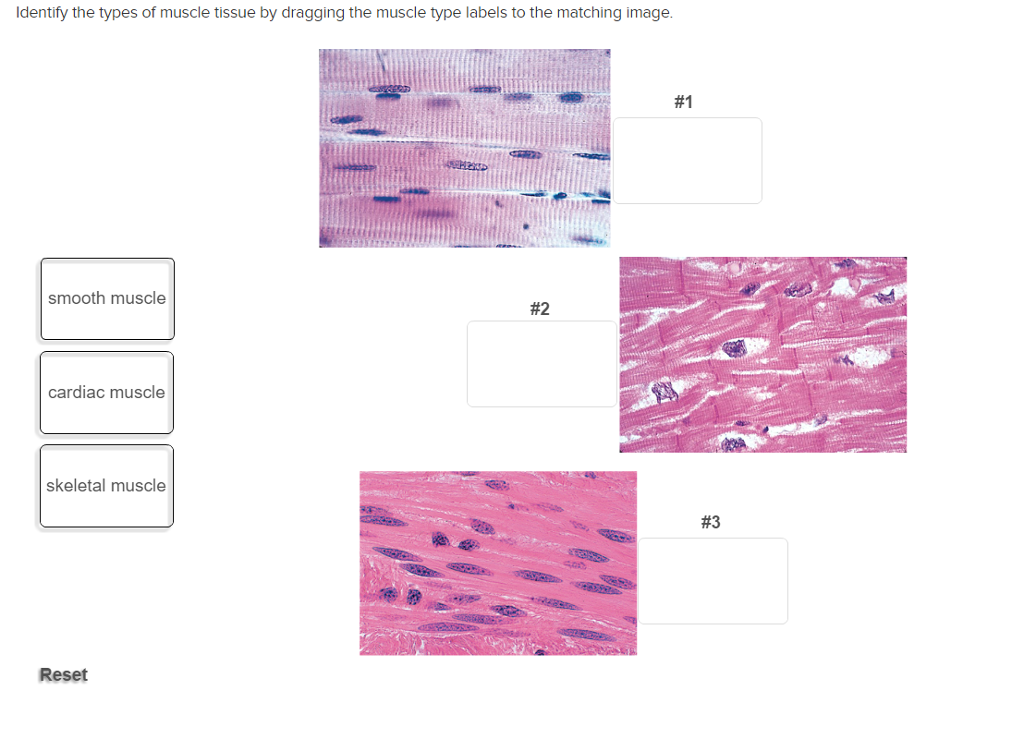 solved-identify-the-types-of-muscle-tissue-by-dragging-th-chegg