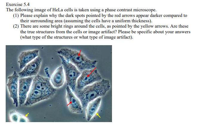 Solved Exercise The Following Image Of Hela Cells Is Chegg