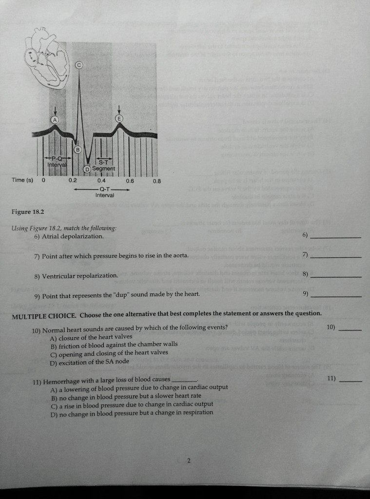 Solved S-T D Segment Time (S) O 0.2 0.4 0.6 0.8 Interval | Chegg.com