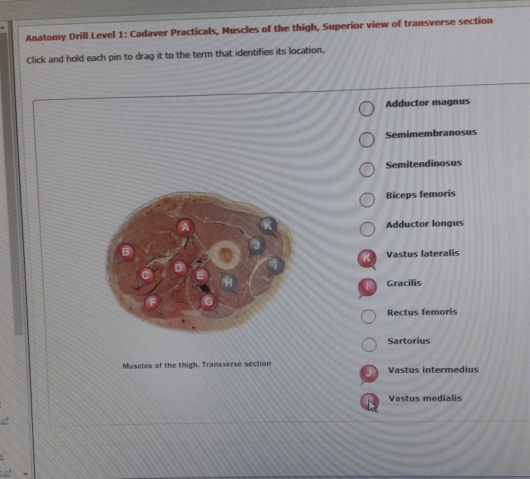 Solved Anatomy Drill Level 1 Cadaver Practicals Muscles