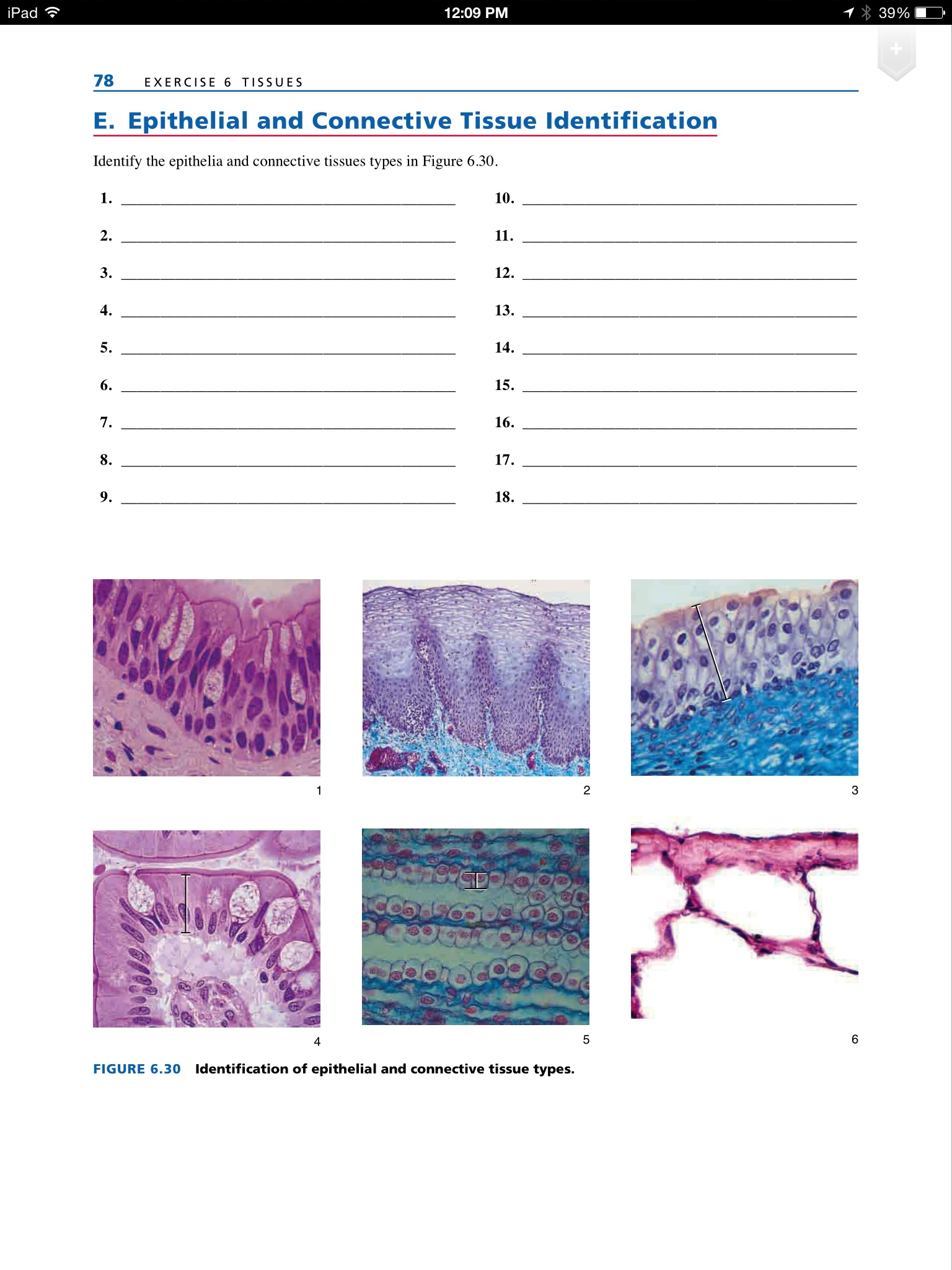 A. Epithelial and Connective Tissue Identification  Chegg.com Throughout Types Of Tissues Worksheet