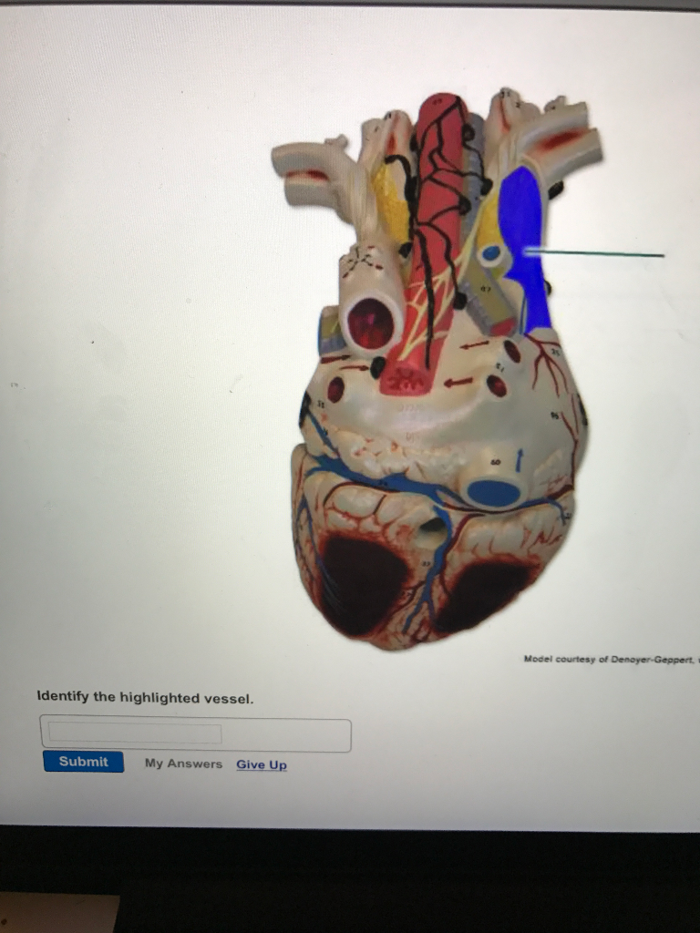 Identify The Highlighted Vessel Chegg Com