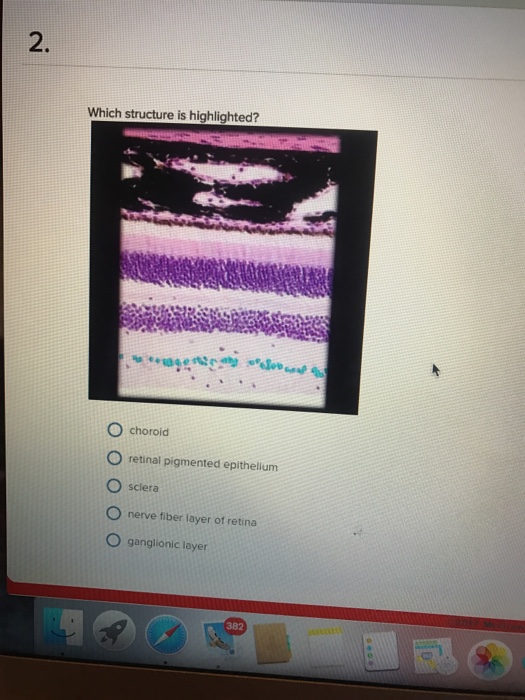 Solved Which structure is highlighted? Choroid retinal | Chegg.com