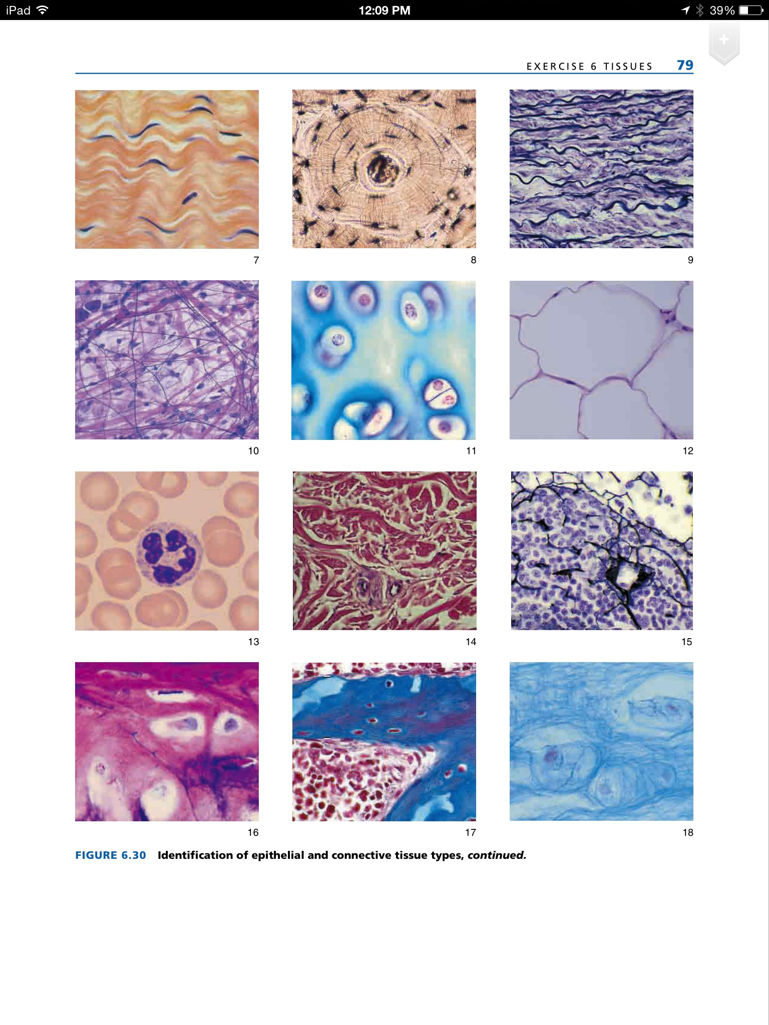 worksheets different types of connective tissue