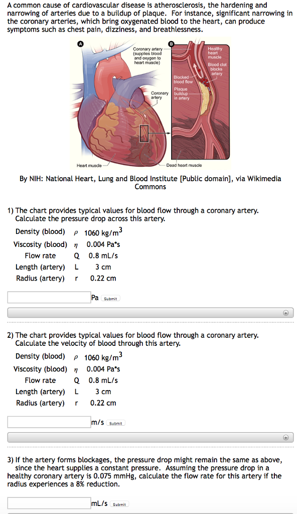 Coronary Artery Flow Chart