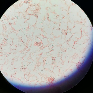 Solved Hello So There Are Pictures Of Endospore Staining Chegg Com