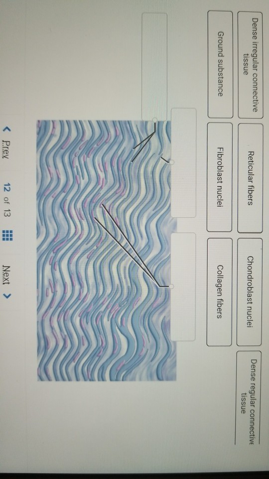 9 types of connective tissue image