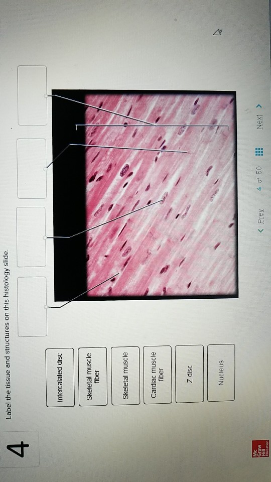 Cardiac Muscle Tissue Slide Labeled