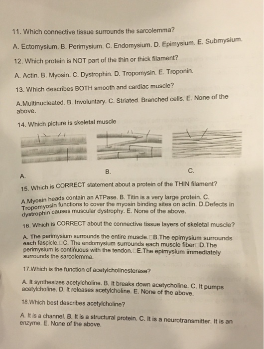 Solved Which Connective Tissue Surrounds The Sarcolemma Chegg Com