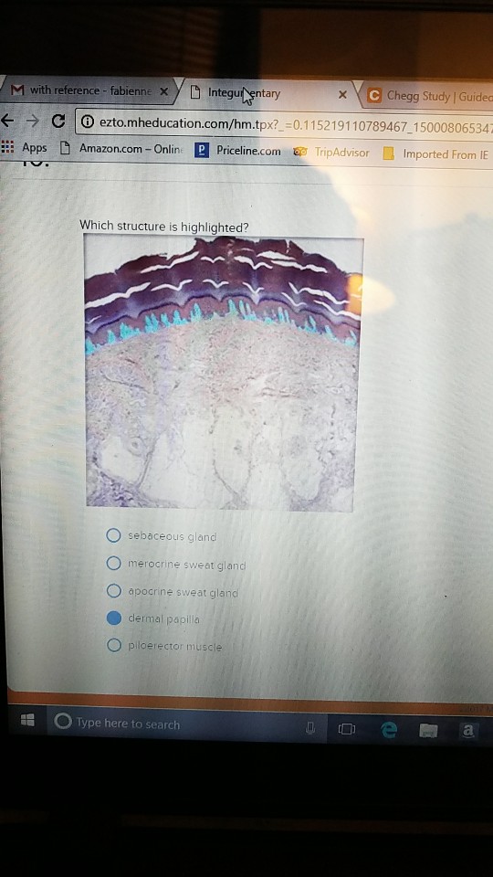 solved-which-structure-is-highlighted-sebaceous-gland-me-chegg