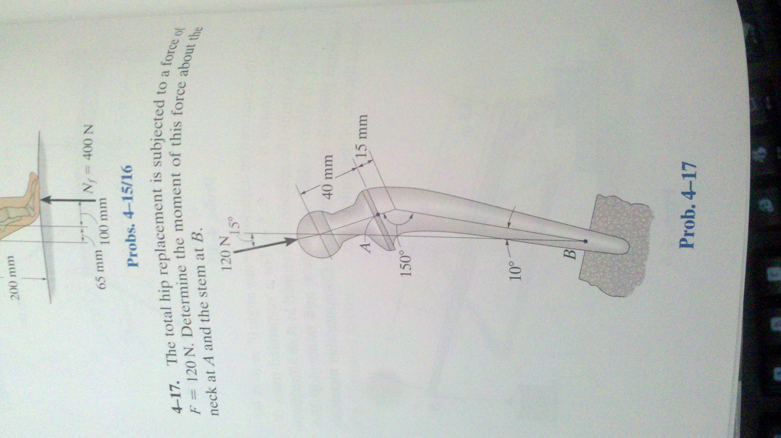 Solved The total hip replacement is subjected to a force of | Chegg.com