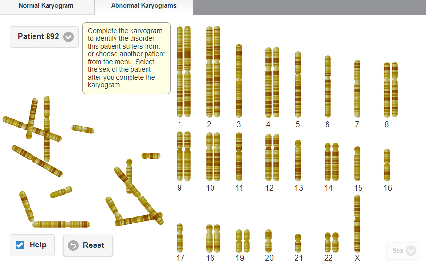 Solved Normal Karyogram Abnormal Karyograms Drag the | Chegg.com