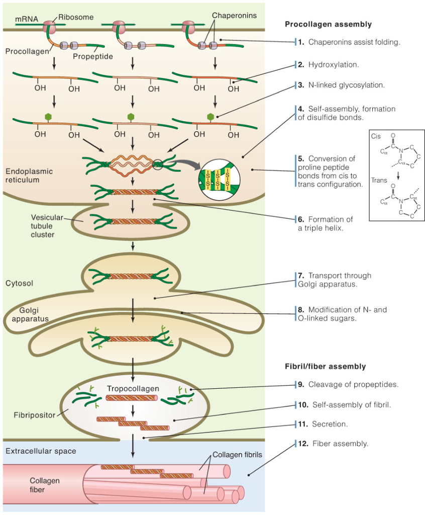 Solved Biochemistry Collagen Synthesis Disorder Case | Chegg.com