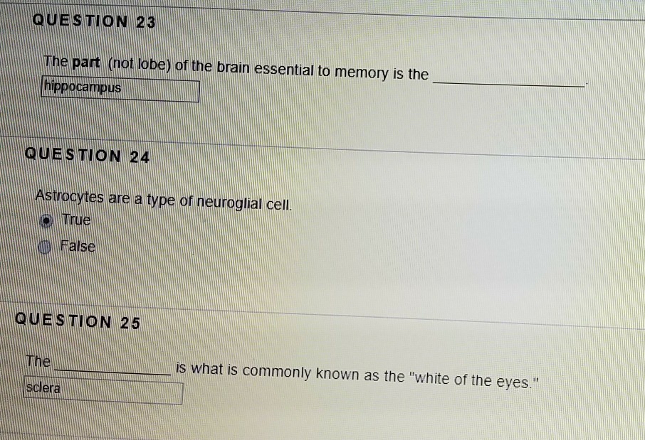 Solved Question The Cerebellum Is Part Of The Peripheral Chegg Com