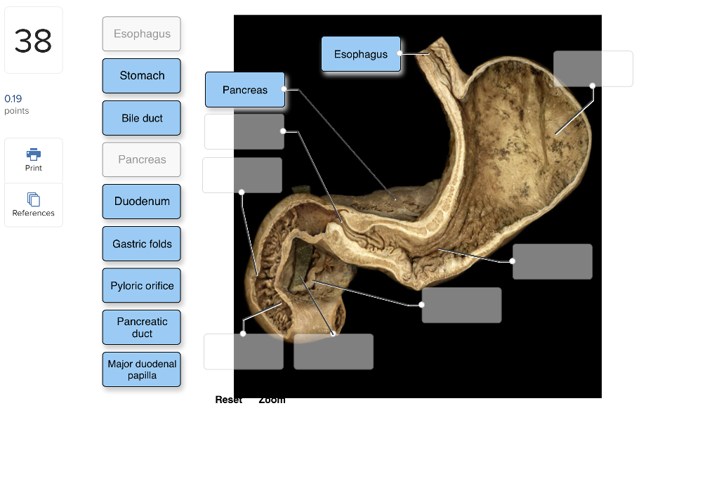 Solved: Label The Internal Features Of Stomach And Duodenu... | Chegg.com