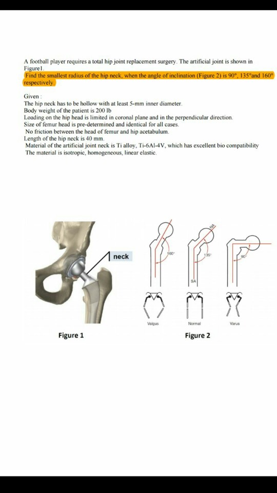 Solved A football player requires a total hip joint