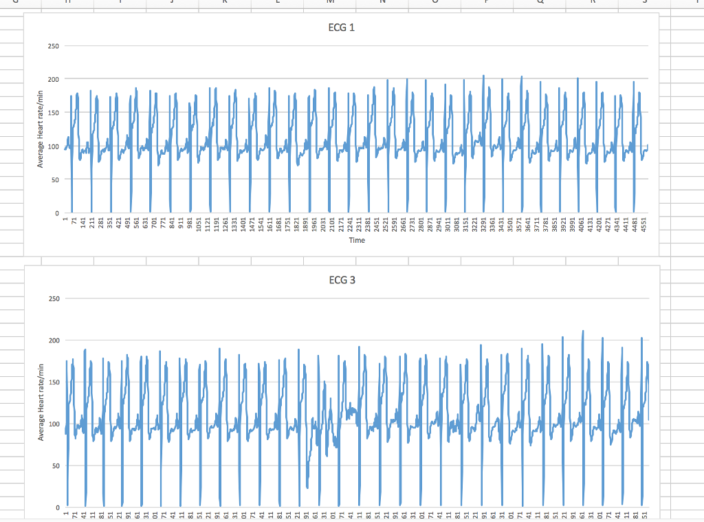 solved-please-interpret-these-two-ecg-graphs-and-indicate-chegg