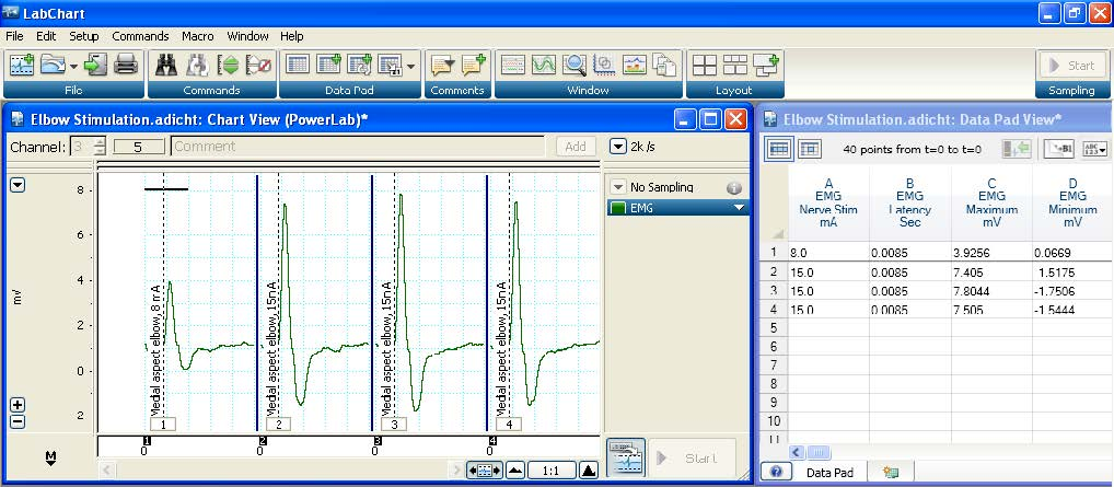 Powerlab And Labchart