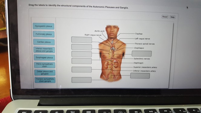 Drag The Labels To Identify The Structural Components Of A Peripheral