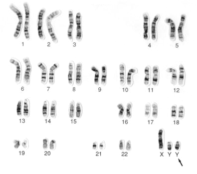 Solved What is a karyotype? Below is an example of a | Chegg.com