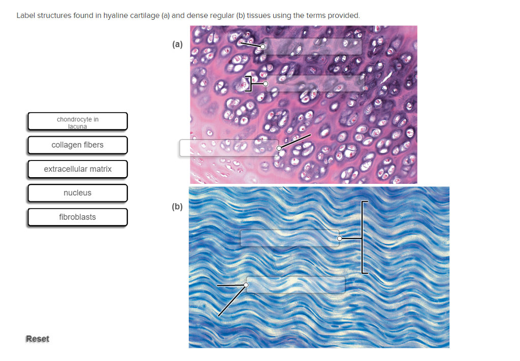 Solved Label Structures Found In Hyaline Cartilage (a) And | Chegg.com