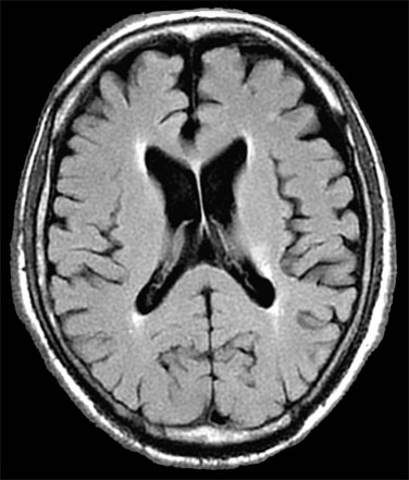 Solved MATLAB Basics (brain.jpg) 1. What is the | Chegg.com