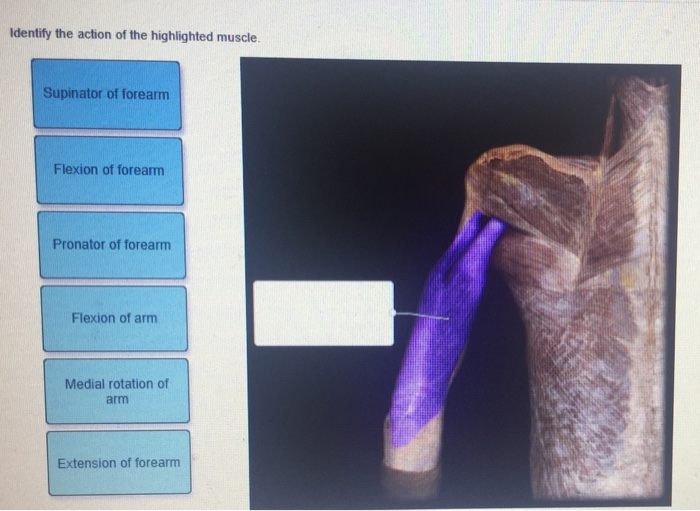 Solved: Identify The Action Of The Highlighted Muscle. Sup... | Chegg.com