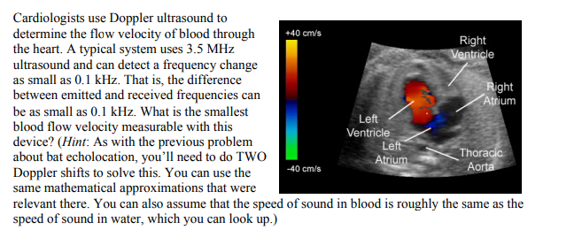 Solved Cardiologists Use Doppler Ultrasound To Determine The Chegg