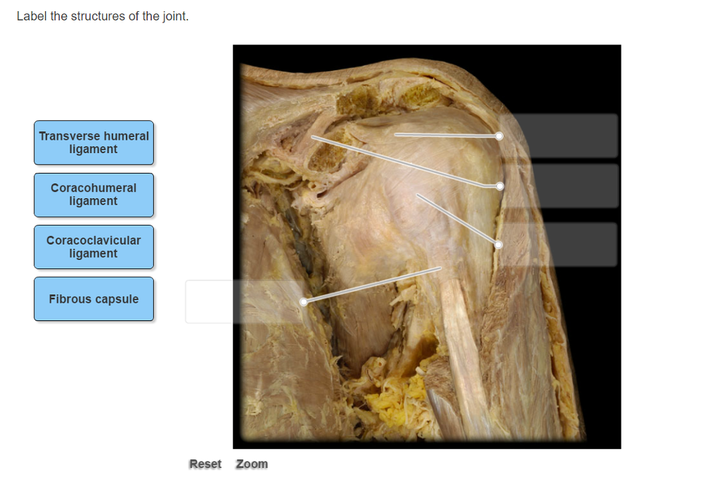 Solved Label the structures of the joint. | Chegg.com