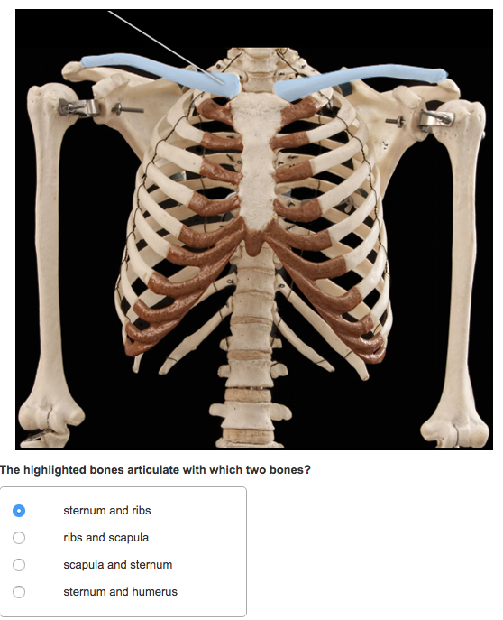 solved-identify-the-highlighted-structure-chegg