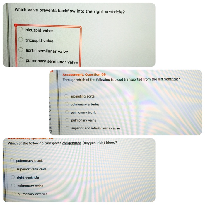 Solved Which valve prevents backflow into the right