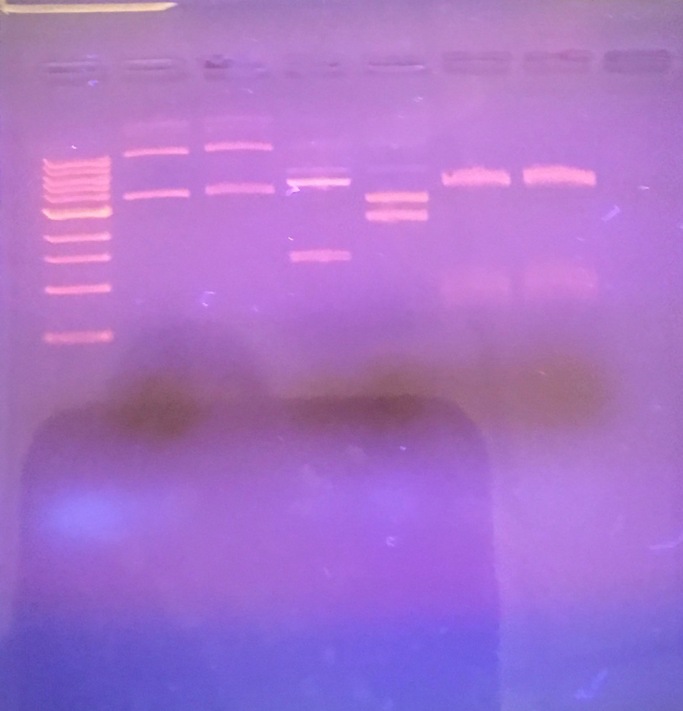 Solved Using The DNA Ladder Promega λ Hind III | Chegg.com